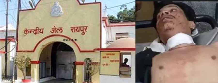 रायपुर सेन्ट्रल जेल के बाहर चली गोली, एक युवक गंभीर रायपुर सेन्ट्रल जेल के बाहर चली गोली, एक युवक गंभीर