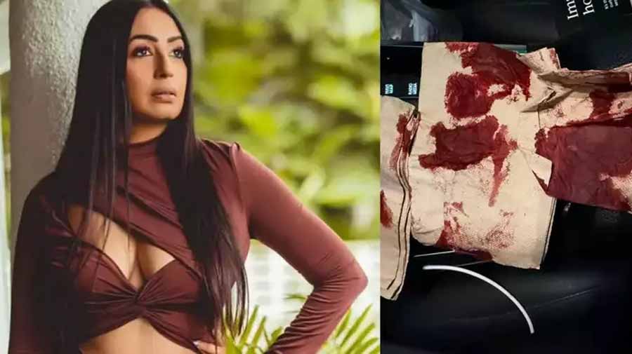 लॉस एंजिल्स में कश्मीरा शाह का हुआ भयानक एक्सीडेंट लॉस एंजिल्स में कश्मीरा शाह का हुआ भयानक एक्सीडेंट