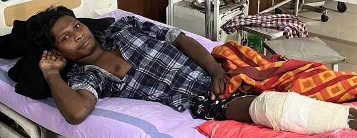 शासकीय मेडिकल कॉलेज रायगढ़ में विशेष जनजाति पहाड़ी कोरवा मरीज के जटिल फ्रैक्चर का हुआ सफल ऑपरेशन शासकीय मेडिकल कॉलेज रायगढ़ में विशेष जनजाति पहाड़ी कोरवा मरीज के जटिल फ्रैक्चर का हुआ सफल ऑपरेशन