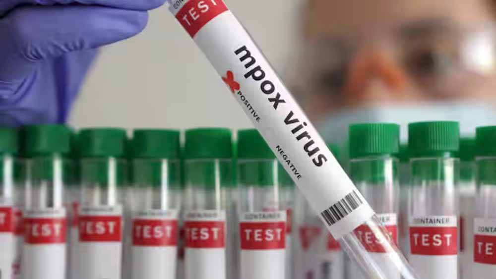 चीन में एचएमपीवी वायरस के बाद Mpox वायरस का नया स्ट्रेन मिलने से हाहाकार!, सरकार ने उठाए ये कदम चीन में एचएमपीवी वायरस के बाद Mpox वायरस का नया स्ट्रेन मिलने से हाहाकार!, सरकार ने उठाए ये कदम