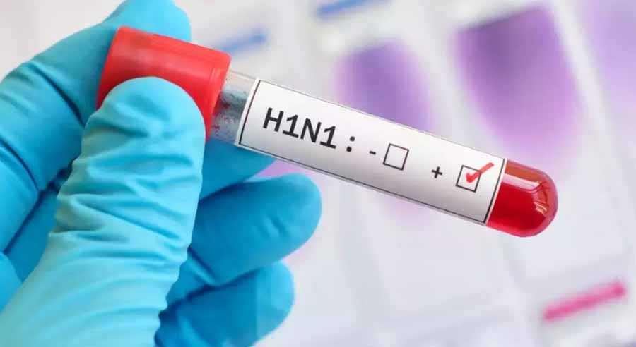 बदलते मौसम में फ्लू और वायरल इन्फेक्शन के मामलो में तेजी, दिल्ली में स्वाइन फ्लू के 3 हजार ज्यादा मामले बदलते मौसम में फ्लू और वायरल इन्फेक्शन के मामलो में तेजी, दिल्ली में स्वाइन फ्लू के 3 हजार ज्यादा मामले