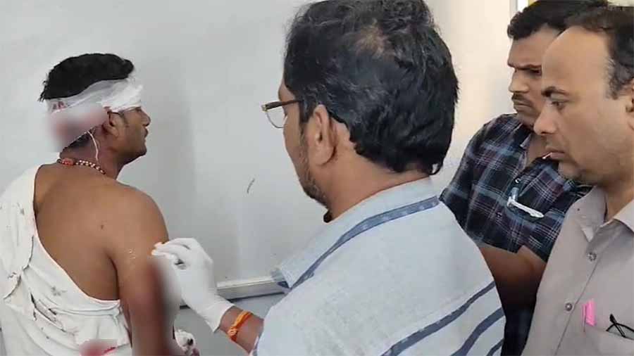 तखतपुर में किसान पर शेर ने किया हमला, उपचार के लिए सिम्स किया गया रेफर तखतपुर में किसान पर शेर ने किया हमला, उपचार के लिए सिम्स किया गया रेफर