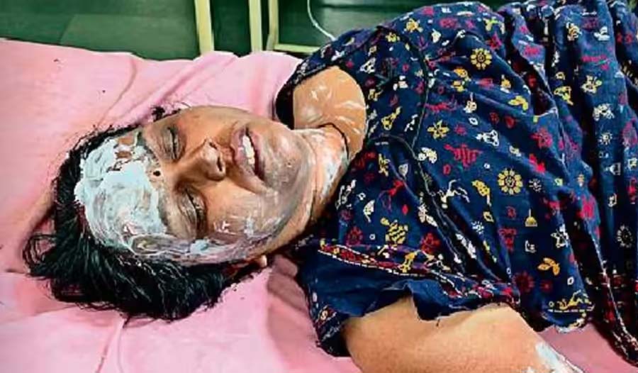 शिवपुरी में महिला टेलर ने पार्षद के घर पर पेट्रोल छिड़ककर आग लगाई, पार्षद और टेलर दोनों झुलस गए शिवपुरी में महिला टेलर ने पार्षद के घर पर पेट्रोल छिड़ककर आग लगाई, पार्षद और टेलर दोनों झुलस गए