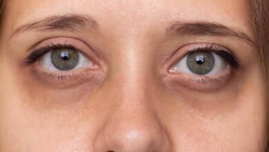 आंखों के नीचे के काले घेरे इस नुस्खे से हो जाएंगे छूमंतर