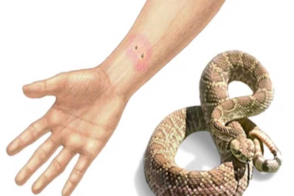 सर्प-दंश से जन-सामान्य के बचाव के लिए राज्य आपदा प्रबंधन प्राधिकरण द्वारा एडवाइजरी जारी
