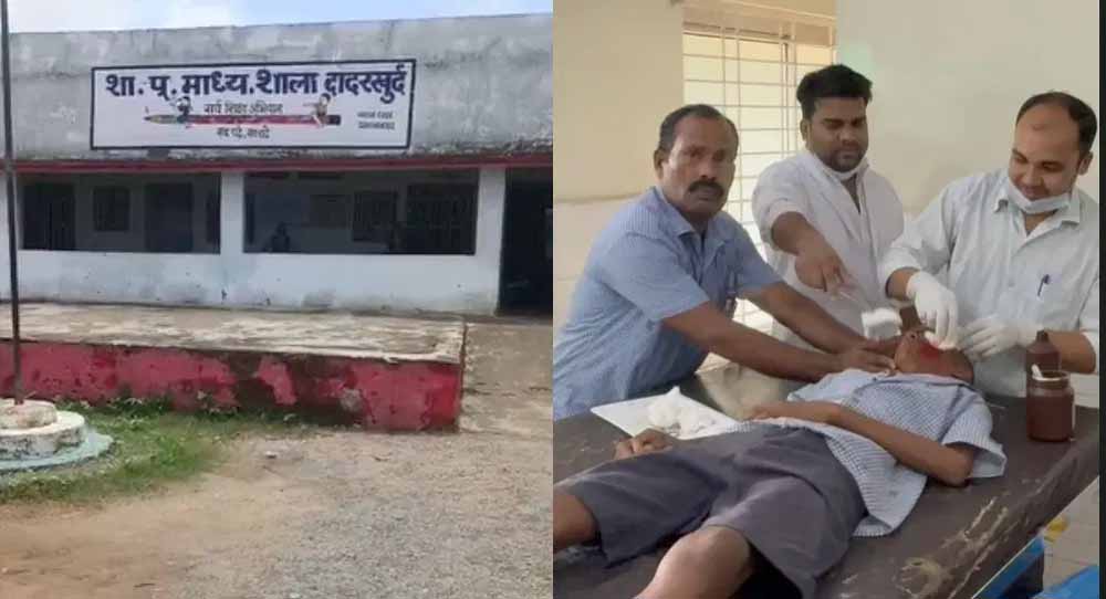 सरकारी स्कूल के छात्रों के बीच खूनीसंघर्ष, एक छात्र ने दूसरे के चेहरे और गले पर मारा ब्लेड