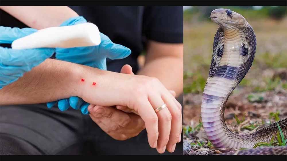सांप काटने पर सीधे पहुंचे अस्पताल स्वास्थ्य विभाग ने जारी की एडवायजरी
