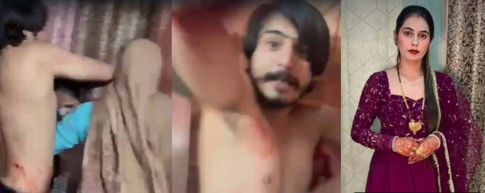 ग्रेटर नोएडा में दिल दहला देने वाली वारदात: निक्की को बेरहमी से पीटा और जिंदा जलाया ग्रेटर नोएडा में दिल दहला देने वाली वारदात: निक्की को बेरहमी से पीटा और जिंदा जलाया