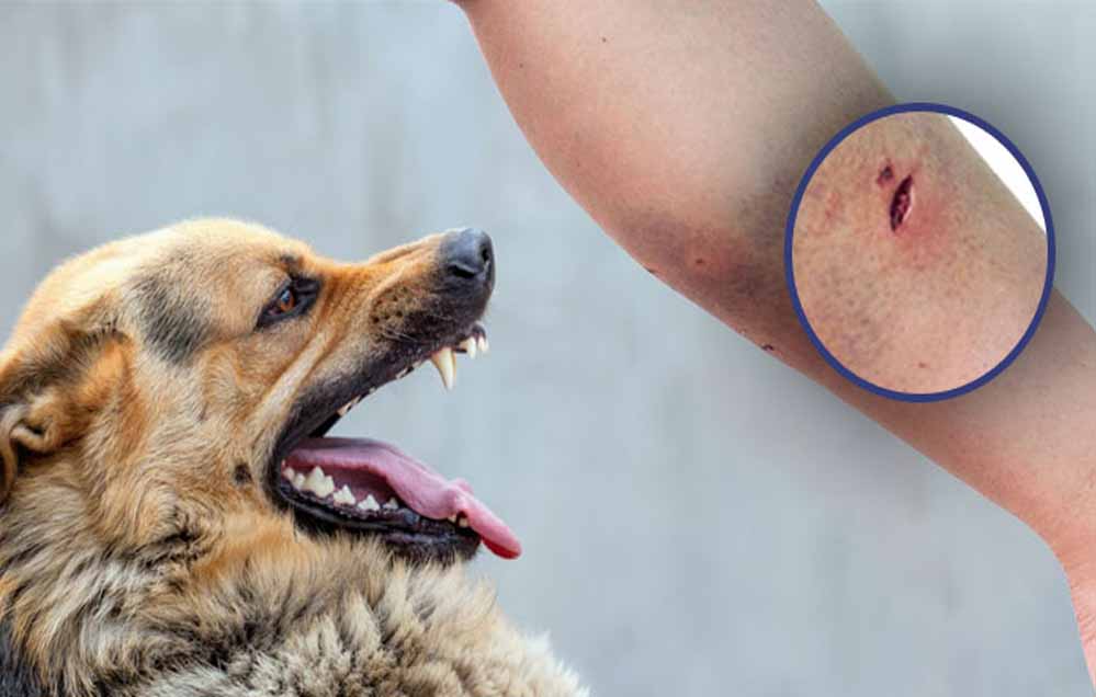 इंदौर में डॉग बाइट के मामले बढ़े, 7 महीने में 28,142 लोग बने शिकार