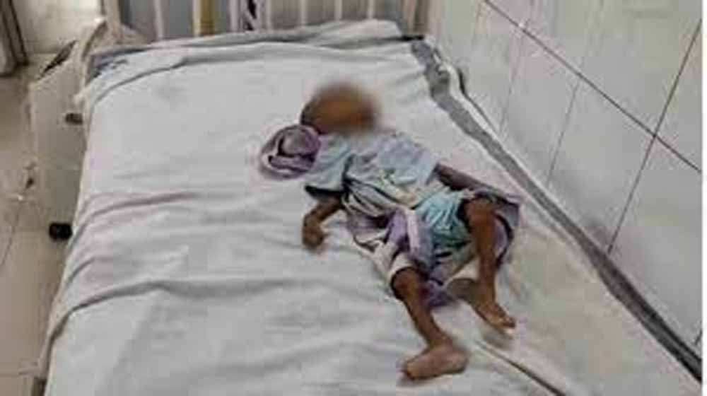शिवपुरी में कुपोषण से मासूम की मौत, बेटे की चाहत में दादी ने नहीं कराया इलाज शिवपुरी में कुपोषण से मासूम की मौत, बेटे की चाहत में दादी ने नहीं कराया इलाज