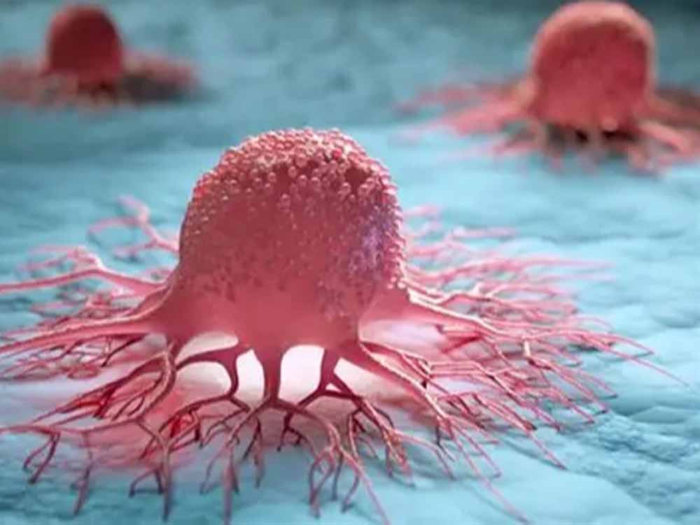 पूर्वोत्तर में हर 5 में 1 पुरुष को कैंसर का खतरा, नई स्टडी में चौंकाने वाला खुलासा