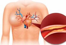 कोलेस्ट्रॉल क्या है और शरीर में इसकी क्या भूमिका होती है?