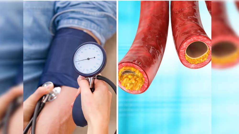 इंदौर में 30% लोगों को हाई बीपी-शुगर, 40% में कोलेस्ट्रॉल की समस्या; 4 लाख की स्क्रीनिंग में हुआ खुलासा इंदौर में 30% लोगों को हाई बीपी-शुगर, 40% में कोलेस्ट्रॉल की समस्या; 4 लाख की स्क्रीनिंग में हुआ खुलासा