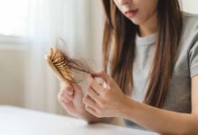 हेयर फॉल बढ़ा रहे हैं ये लाइफस्टाइल मिस्टेक्स , गंजेपन से बचने के लिए अभी सुधारें