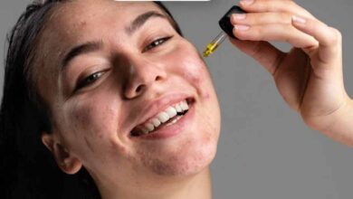 सैलिसिलिक एसिड का कमाल! पिंपल्स और दाग-धब्बों से मिलेगा झटपट छुटकारा