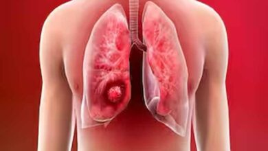 फेफड़ों के कैंसर पर वैज्ञानिकों की बड़ी जीत! नया शोध ट्यूमर को 80% तक सिकोड़ने में सफल फेफड़ों के कैंसर पर वैज्ञानिकों की बड़ी जीत! नया शोध ट्यूमर को 80% तक सिकोड़ने में सफल