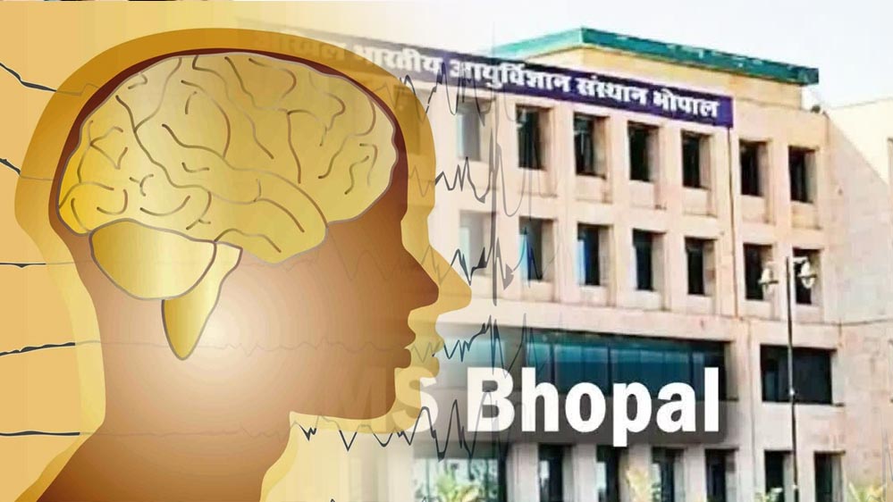 AIIMS भोपाल की बड़ी उपलब्धि: 24 घंटे में होगा स्ट्रोक का एडवांस्ड इलाज, ब्रेन का थक्का होगा दूर AIIMS भोपाल की बड़ी उपलब्धि: 24 घंटे में होगा स्ट्रोक का एडवांस्ड इलाज, ब्रेन का थक्का होगा दूर