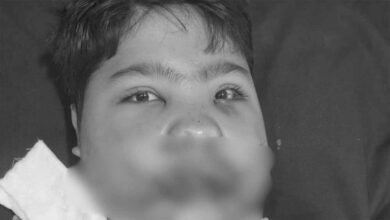 MP में फ्रिज फटा: मासूम की 108 हड्डियां टूटी, डॉक्टरों ने 5 घंटे में लौटाई जिंदगी MP में फ्रिज फटा: मासूम की 108 हड्डियां टूटी, डॉक्टरों ने 5 घंटे में लौटाई जिंदगी