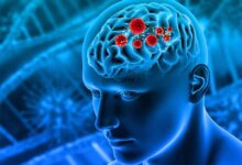 ब्रेन ट्यूमर के शुरुआती संकेत: अपने शरीर के ये अलर्ट कभी न करें नजरअंदाज