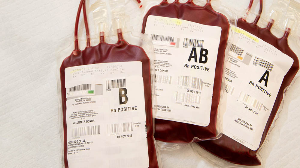 सतना में 6 बच्चों के HIV संक्रमण मामले में कार्रवाई, ब्लड बैंक प्रभारी और 2 कर्मचारी सस्पेंड सतना में 6 बच्चों के HIV संक्रमण मामले में कार्रवाई, ब्लड बैंक प्रभारी और 2 कर्मचारी सस्पेंड