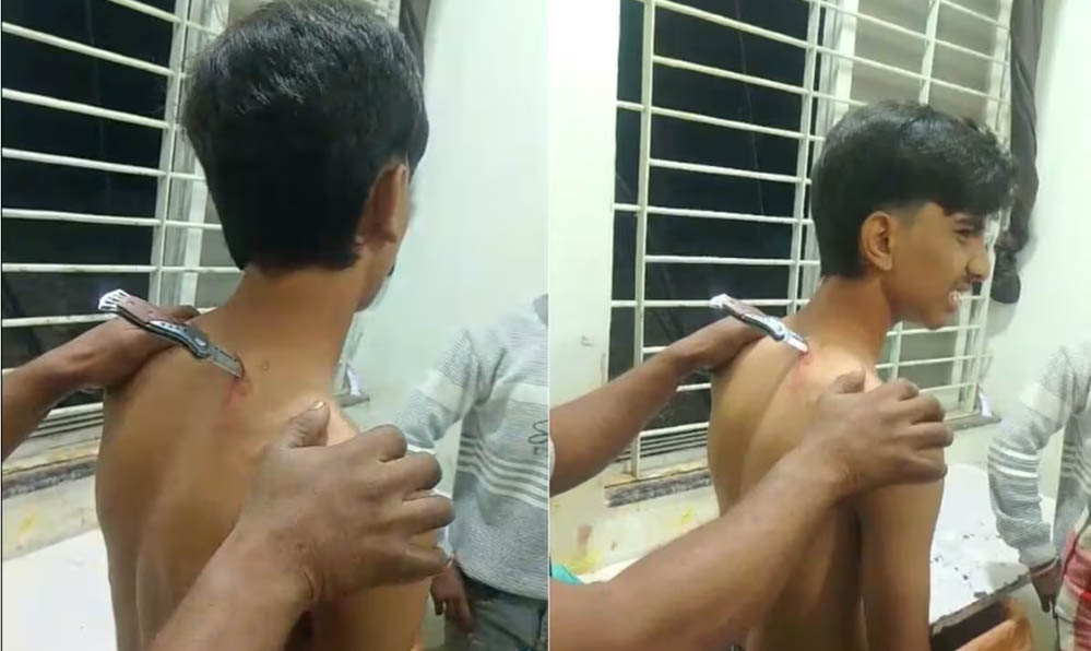 महिदपुर में मामूली विवाद के दौरान नाबालिग पर हमला, घायल 46 किमी दूर अस्पताल पहुंचा महिदपुर में मामूली विवाद के दौरान नाबालिग पर हमला, घायल 46 किमी दूर अस्पताल पहुंचा