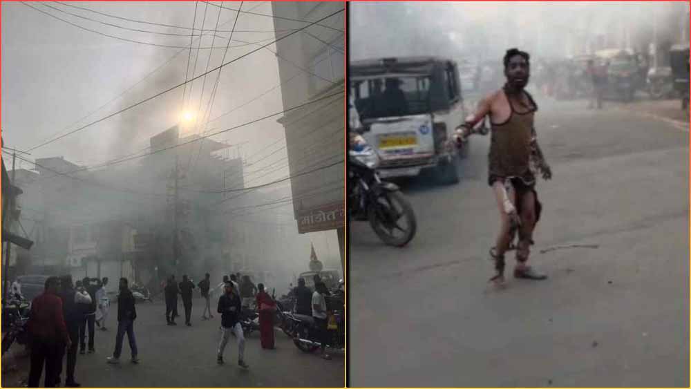 रतलाम में बंदूक दुकान में धमाका, तीन झुलसने के कारण इंदौर रेफर