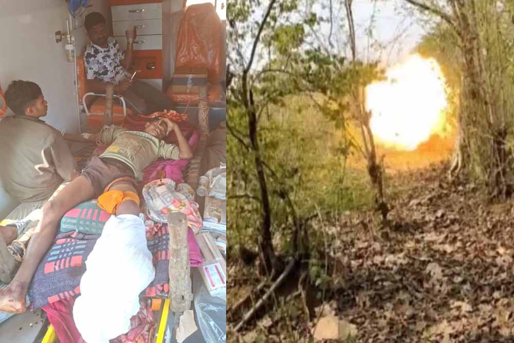 प्रेशर IED विस्फोट की चपेट में आया ग्रामीण बालक, हालत नाजुक