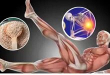 कोविड के बाद हड्डियों में कमजोरी: दुनियाभर के डॉक्टरों की बड़ी चेतावनी