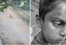 बिलासपुर में PM श्री स्कूल के अंदर कुत्ते ने पहली कक्षा के बच्चे को नोचा, बचाने दौड़ी टीचर पर भी किया हमला