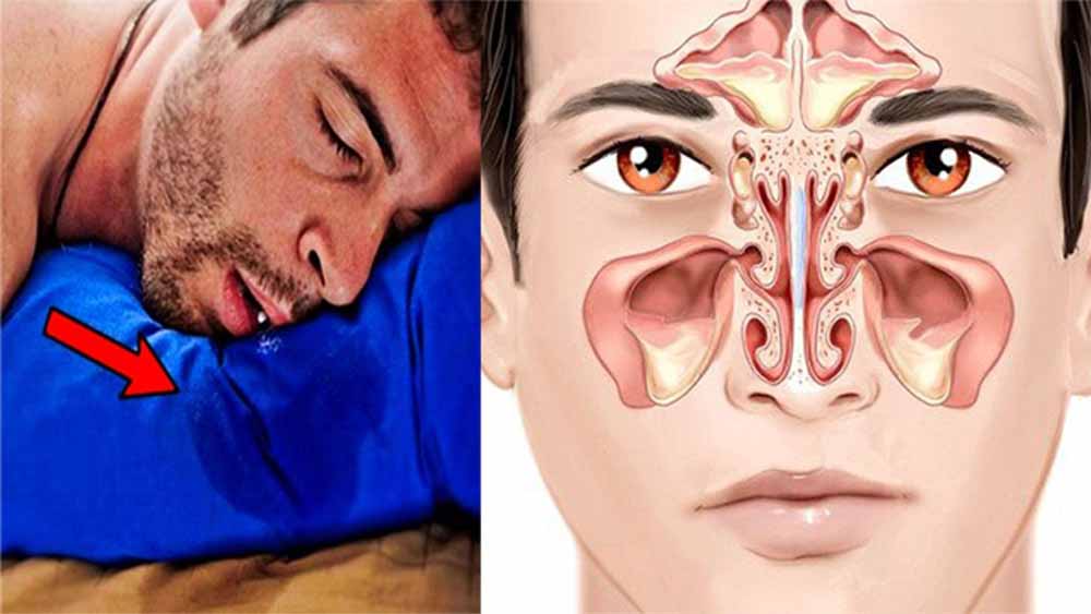 गहरी नींद का संकेत है या कोई बीमारी? सोते समय मुंह से लार बहने पर रहें अलर्ट?
