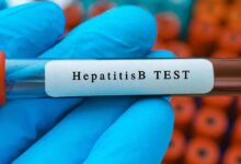 ऑस्ट्रेलिया की नई खोज: हेपेटाइटिस-बी जांच अब आसान और बेहद सटीक