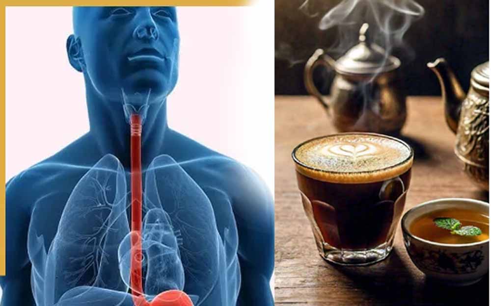 गरम चाय-कॉफी पीने की आदत बन सकती है खतरनाक, एक्सपर्ट बोले—फूड पाइप डैमेज और कैंसर का खतरा
