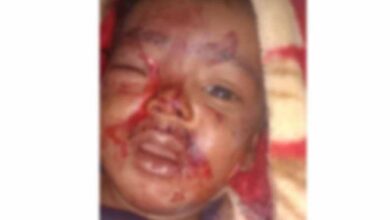 आंगन में खेल रहे 6 माह के मासूम को आवारा कुत्ते ने काटा, जिला अस्पताल में भर्ती आंगन में खेल रहे 6 माह के मासूम को आवारा कुत्ते ने काटा, जिला अस्पताल में भर्ती