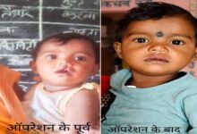 शासन की योजना से दूर हुई बेटी के भविष्य की चिंता, चिरायु दल ने लौटाई मासूम रंजना की मुस्कान