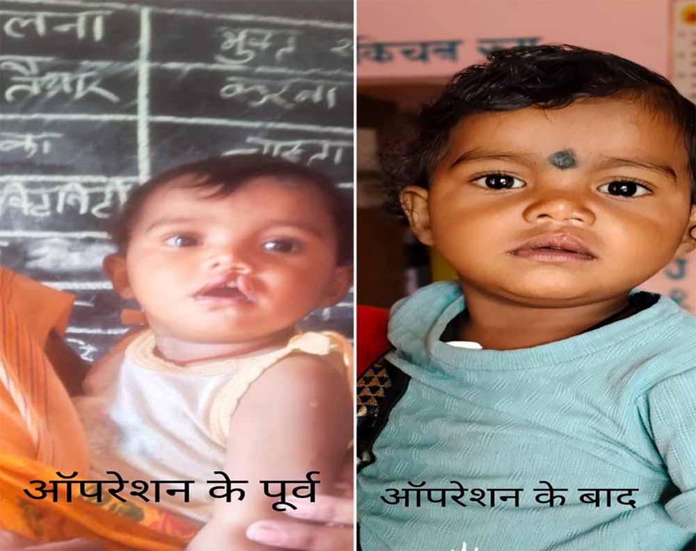 शासन की योजना से दूर हुई बेटी के भविष्य की चिंता, चिरायु दल ने लौटाई मासूम रंजना की मुस्कान शासन की योजना से दूर हुई बेटी के भविष्य की चिंता, चिरायु दल ने लौटाई मासूम रंजना की मुस्कान