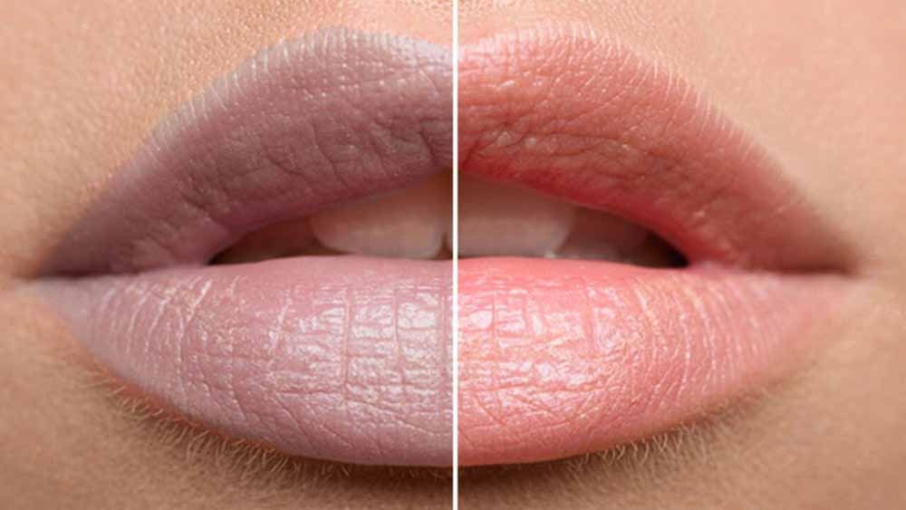 काले होंठों को नेचुरली गुलाबी बनाएंगे ये 7 घरेलू नुस्खे, महंगे लिप बाम की नहीं पड़ेगी जरूरत