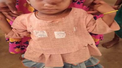 पिता के साये और आर्थिक तंगी के बीच चिरायु योजना बनी सहारा,अंजलि को मिला नया जीवन