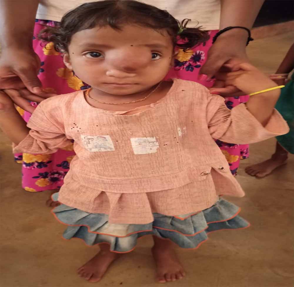 पिता के साये और आर्थिक तंगी के बीच चिरायु योजना बनी सहारा,अंजलि को मिला नया जीवन पिता के साये और आर्थिक तंगी के बीच चिरायु योजना बनी सहारा,अंजलि को मिला नया जीवन