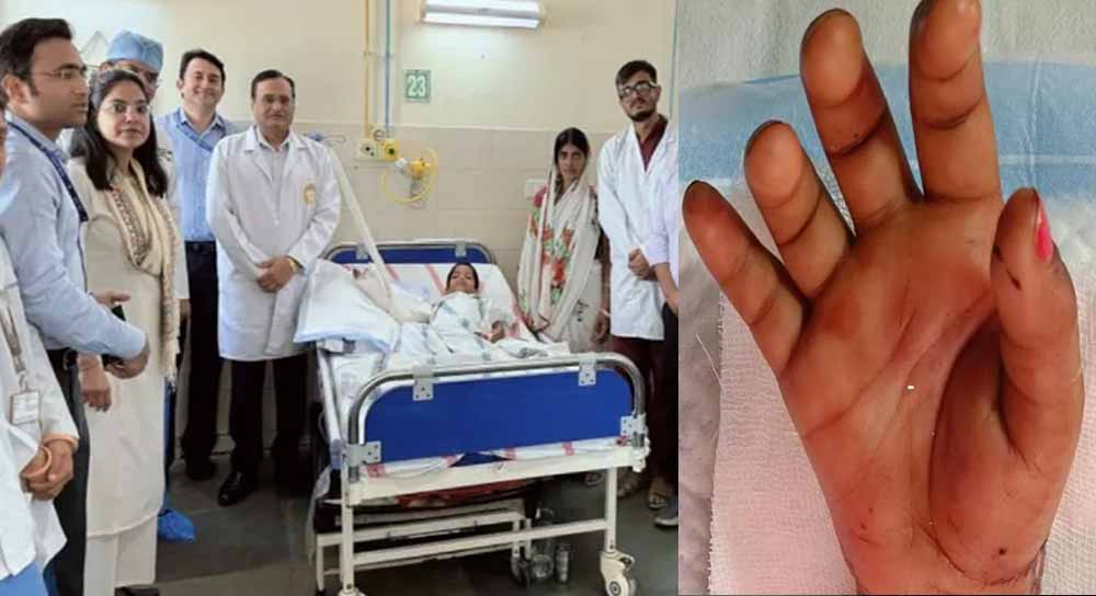 डॉक्टरों ने बच्ची का कटा हाथ जोड़ा, एम्स पटना में 6 घंटे चली सर्जरी