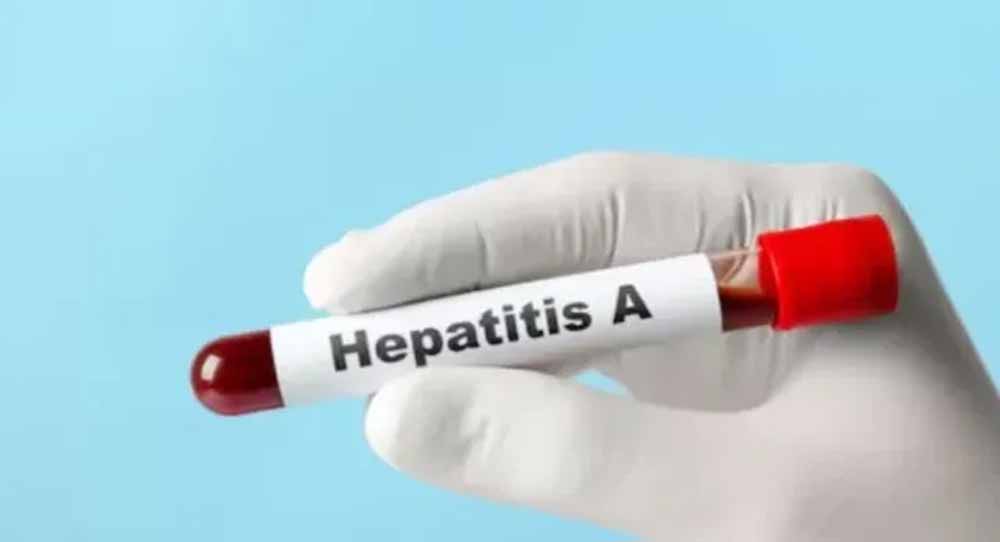 यूपी में हेपेटाइटिस ए का बड़ा खतरा, 97% सैंपल पॉजिटिव मिले यूपी में हेपेटाइटिस ए का बड़ा खतरा, 97% सैंपल पॉजिटिव मिले