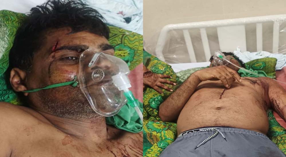 कुल्हाड़ी से हमला: गाली-गलौज का विरोध करने पर पूर्व जनपद सदस्य प्रतिनिधि पर जानलेवा वार कुल्हाड़ी से हमला: गाली-गलौज का विरोध करने पर पूर्व जनपद सदस्य प्रतिनिधि पर जानलेवा वार