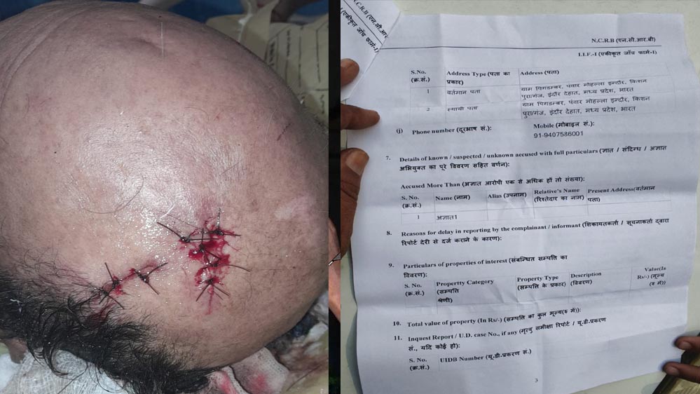 अधिमान्य पत्रकार नेतृत्व समिति के प्रदेश कार्यवाहक अध्यक्ष पर प्राण घातक हमला अधिमान्य पत्रकार नेतृत्व समिति के प्रदेश कार्यवाहक अध्यक्ष पर प्राण घातक हमला