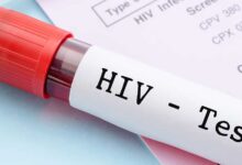मध्यप्रदेश में HIV के बढ़ते मामले चिंता का कारण, केस दोगुने; जांच और जागरूकता पर सवाल