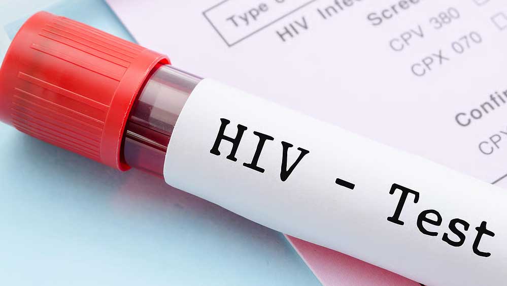 मध्यप्रदेश में HIV के बढ़ते मामले चिंता का कारण, केस दोगुने; जांच और जागरूकता पर सवाल