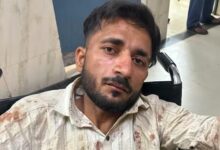 UP पुलिस परीक्षा देने जा रही छात्राओं से छेड़छाड़, आरोपी ऑटो ड्राइवर पुलिस एनकाउंटर में घायल