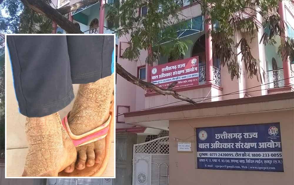 बाल आयोग अध्यक्ष की पहल रंग लाई, गंभीर बीमार बालिका का इलाज शुरू बाल आयोग अध्यक्ष की पहल रंग लाई, गंभीर बीमार बालिका का इलाज शुरू