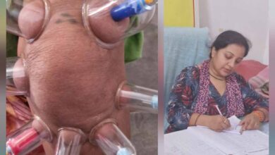 लोहरसी आयुर्वेदिक औषधालय में दर्द प्रबंधन हेतु कपिंग थेरेपी एवं विशेष आयुर्वेदिक उपचार सेवाओं का आरंभ लोहरसी आयुर्वेदिक औषधालय में दर्द प्रबंधन हेतु कपिंग थेरेपी एवं विशेष आयुर्वेदिक उपचार सेवाओं का आरंभ