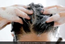 शैम्पू बदलने से नहीं रुकता हेयर फॉल? जानिए बाल झड़ने की असली वजह