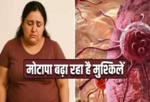 मोटापा-तनाव बढ़ा रहे कैंसर का खतरा! पुरुषों में ओरल तो महिलाओं में ब्रेस्ट कैंसर के मामले बढ़े