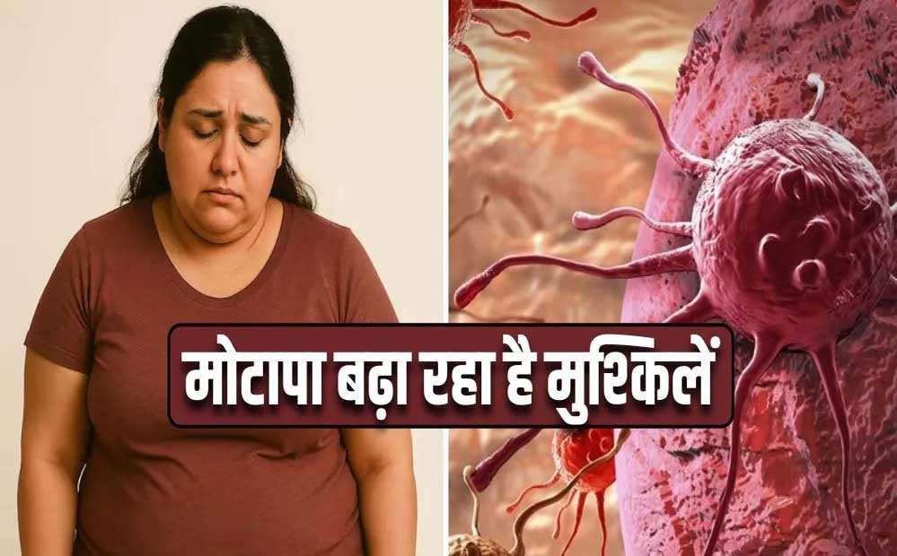 मोटापा-तनाव बढ़ा रहे कैंसर का खतरा! पुरुषों में ओरल तो महिलाओं में ब्रेस्ट कैंसर के मामले बढ़े